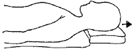 Leck Elongation Stretch